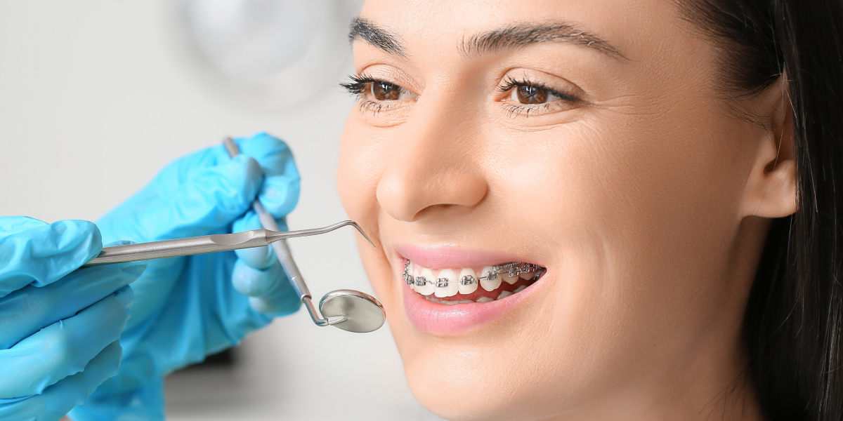 Straighten Your Smile with Braces in Ventura CA